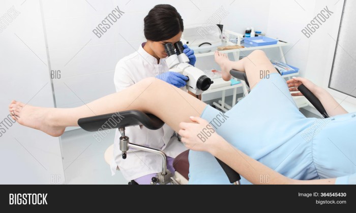 Woman on the gynecological table