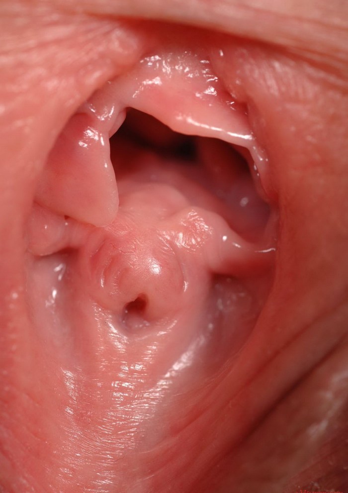 Inside the vagina is large