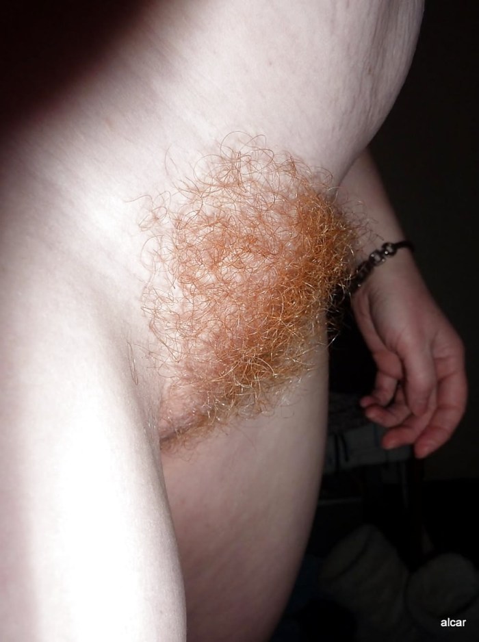Blonde hair on the pubis