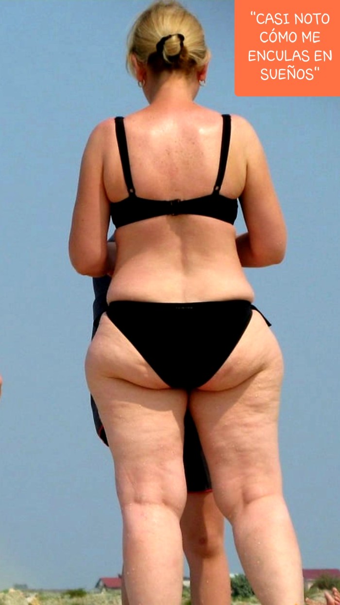 Big cellulite hips of Milf Basin