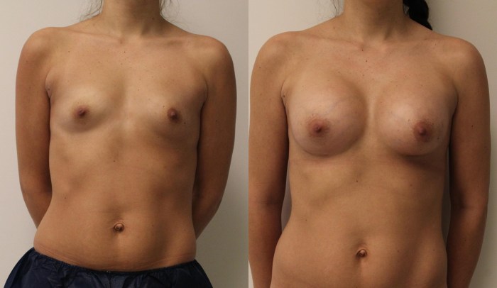 Tender small breasts