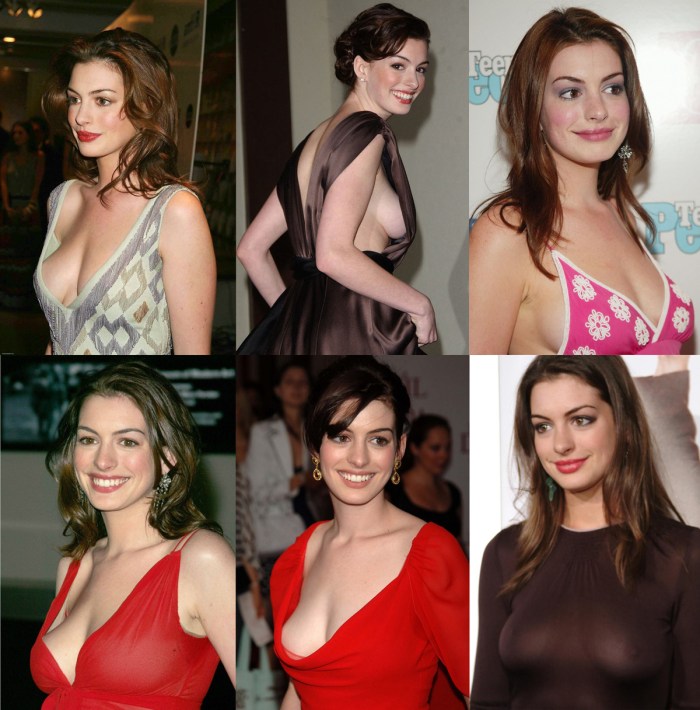 Anne Hathaway breast plastic