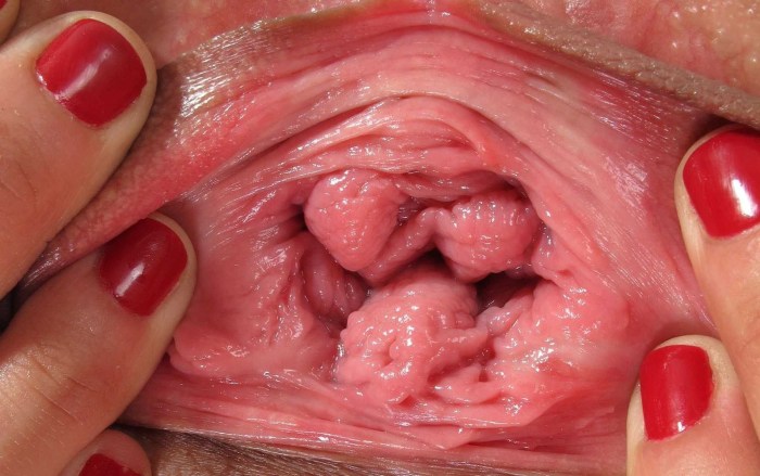 The camera inside the vagina