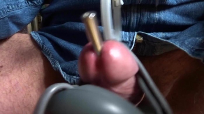Mastery of urethra in men