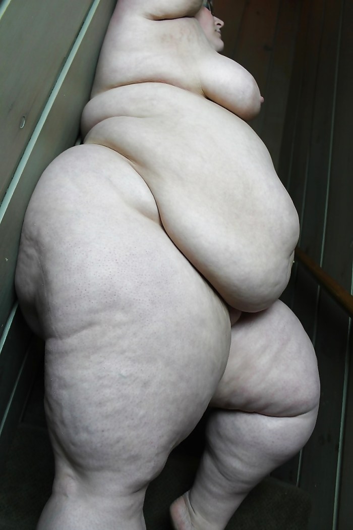 Old fat cellulite