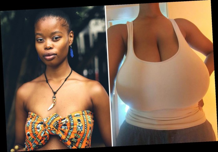 Breaking breasts