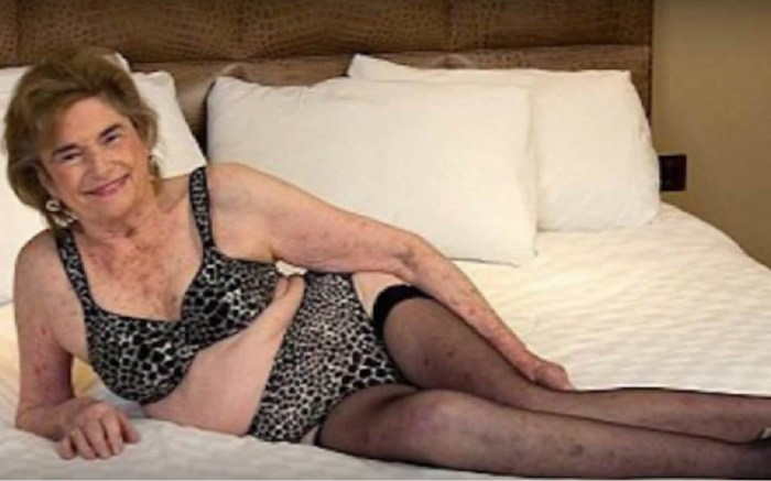 Old hairy women