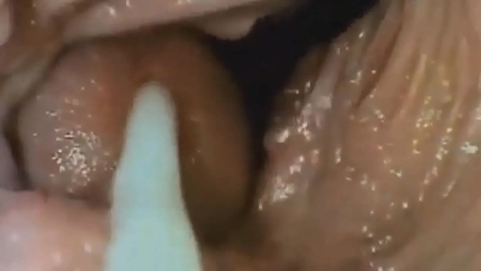Black Breeding Program Black Sperm in a White Womb