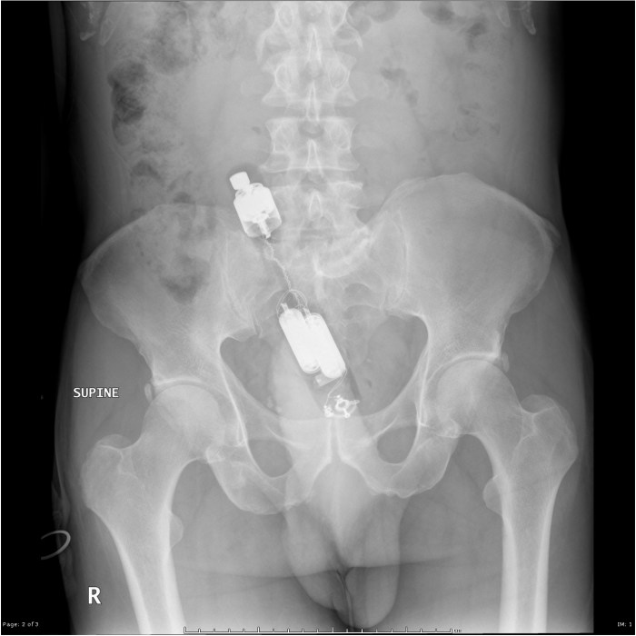 Women's vagina from the inside