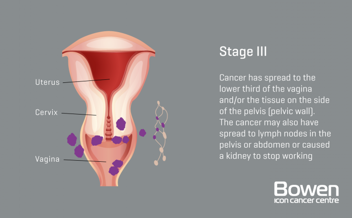 The cryoans of the mammary gland