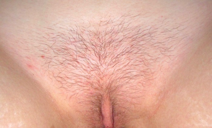 Explification of female pubis