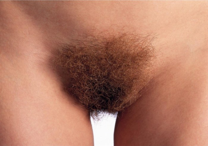 Explification of female pubis