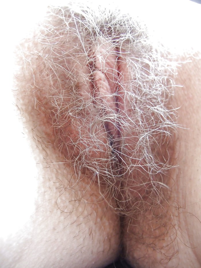 Forms of female genital organs