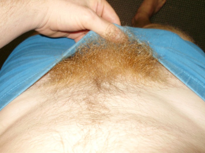 Explification of female pubis