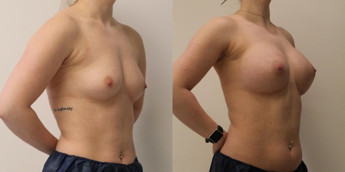 Types of female breast naked
