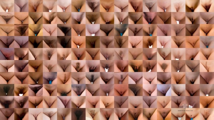 High location of the vagina