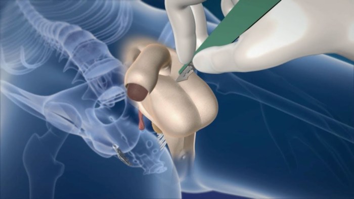 Various forms of penis