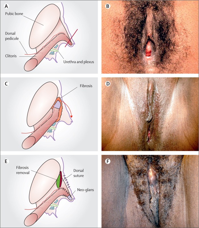 Woman's cropped genital organs
