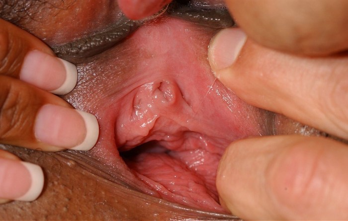 Open vagina uterus