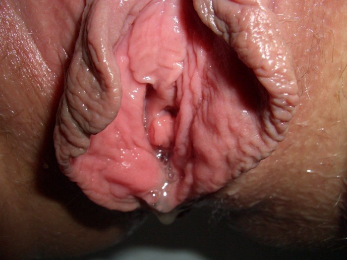The fertilization of the vagina
