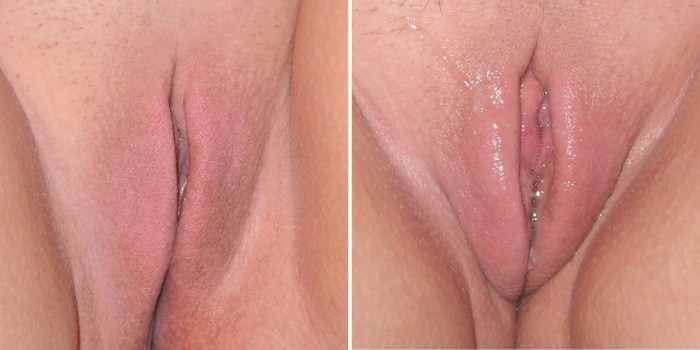 Girls with puffy labia