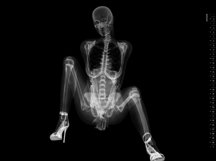 Under the X -ray