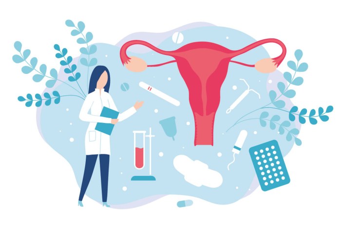 Gynecology picture for presentation