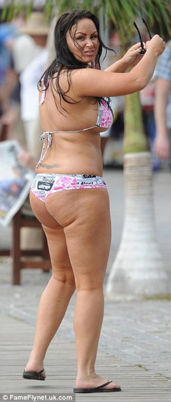 Beautiful women with cellulite