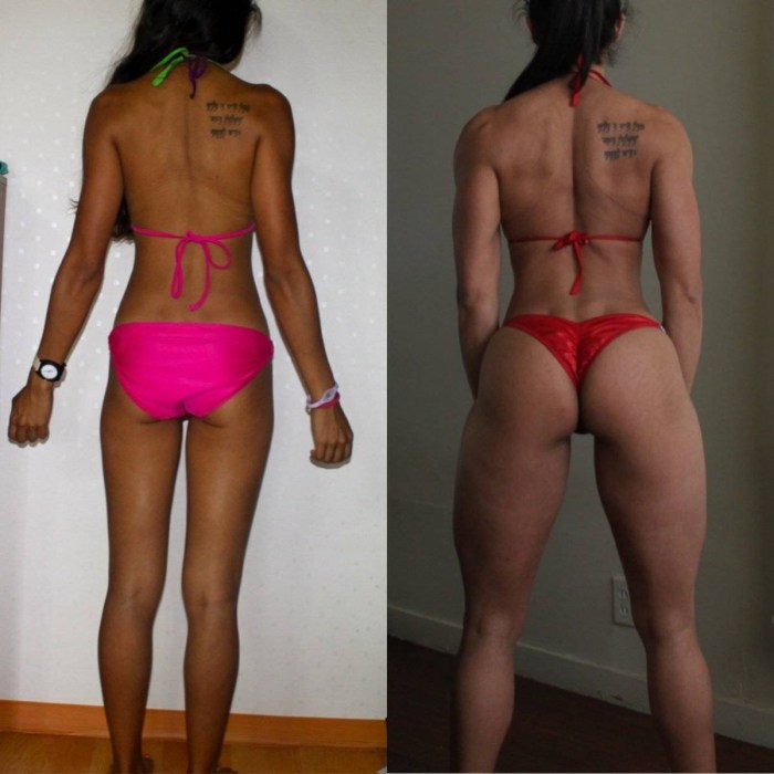 Cellulite in thin girls