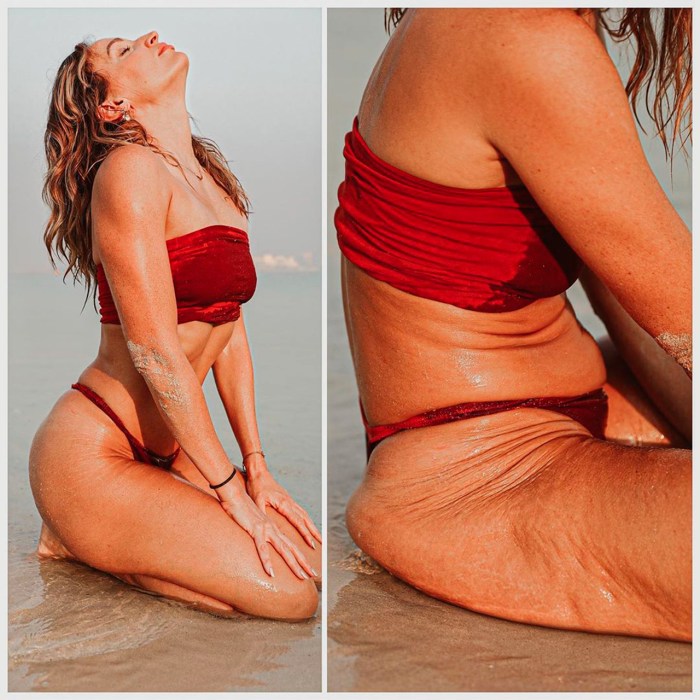 Beautiful girls with cellulite