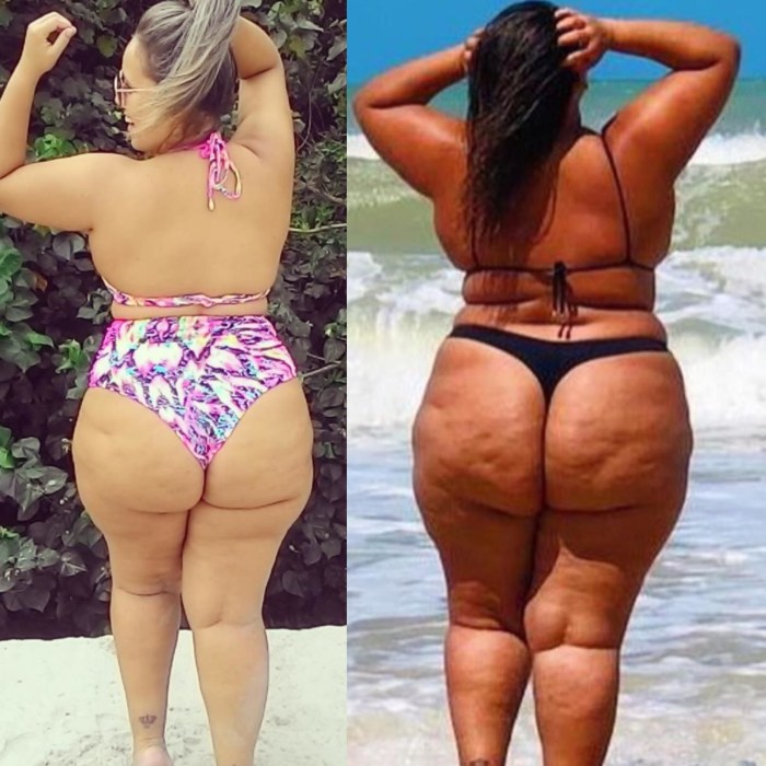 FIDI girl with cellulite