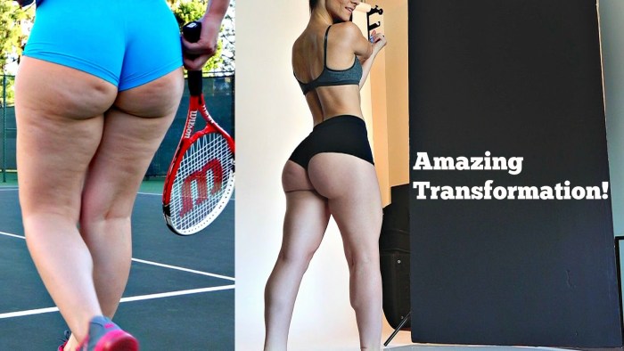 The correct shape of the buttocks