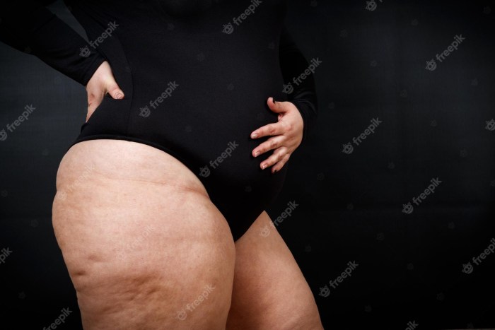 Hips Chemical Piling