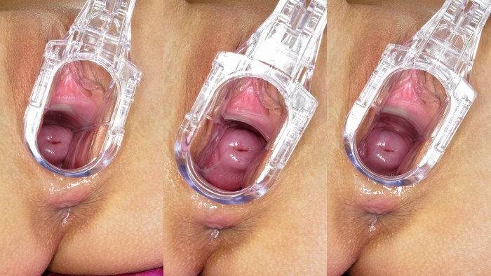 Eva Angel with a vaginal expander
