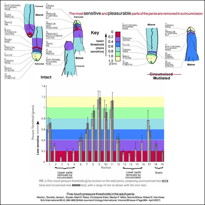 Penis Sensitivity Parts