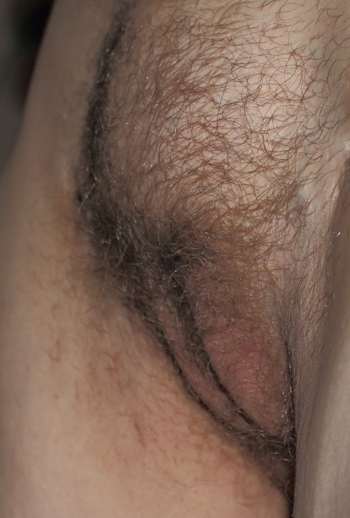 Convex pussies of girls