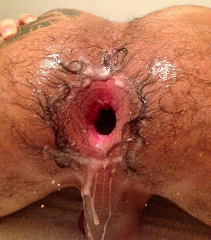 A torn anus