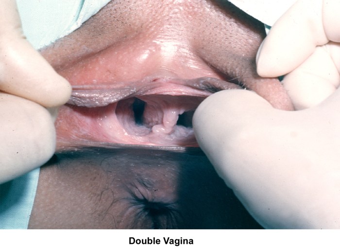 Hazel Jones two vagina