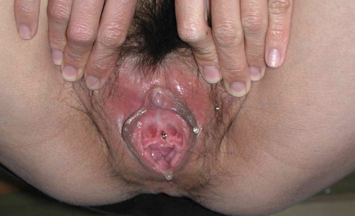 Vaginal uterine