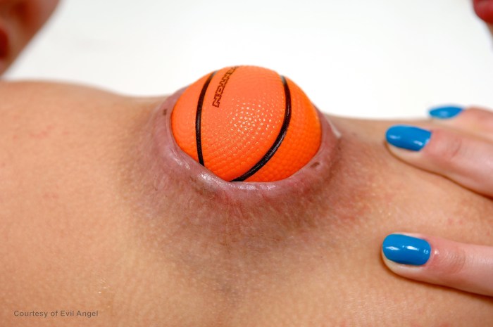Basketball in vagina