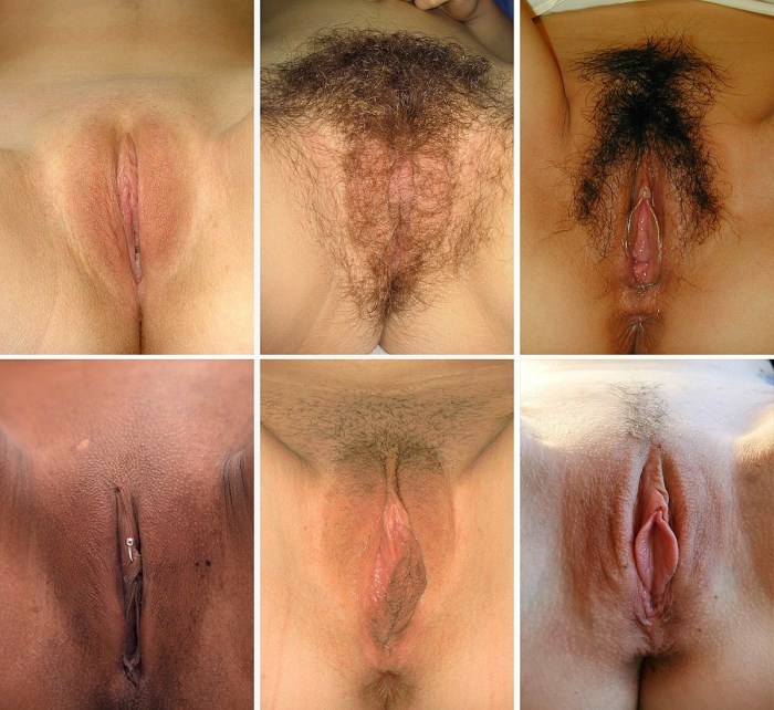 Female pubic hair