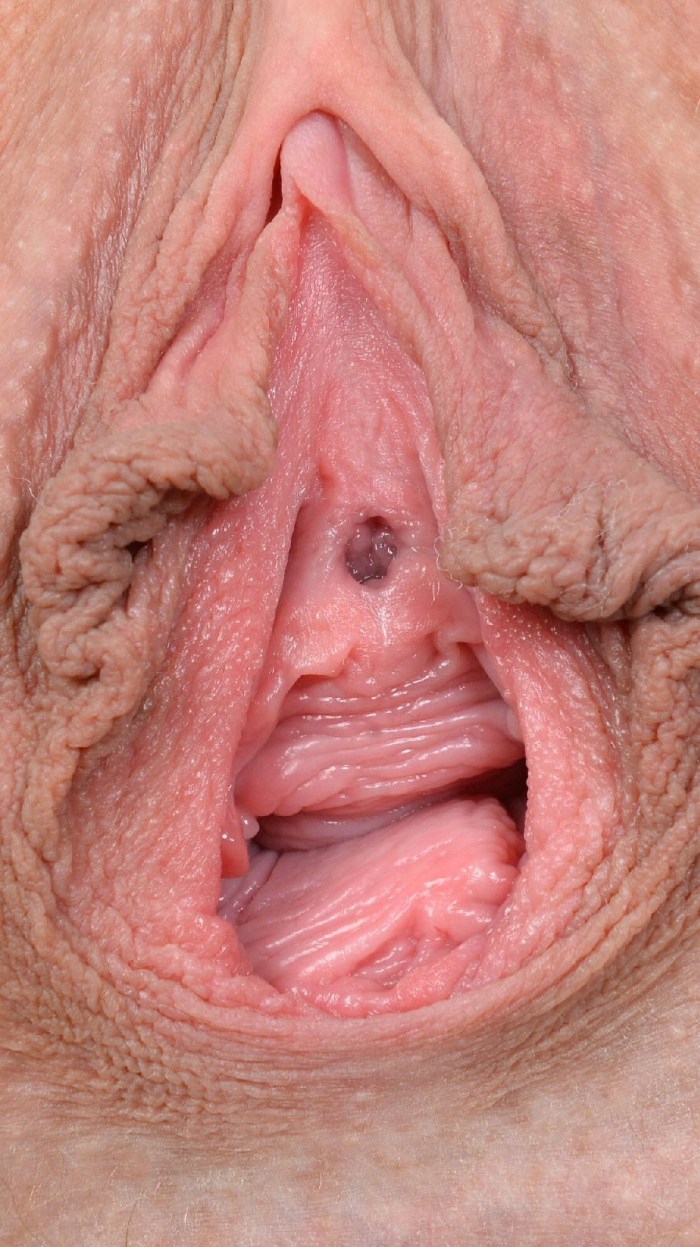 Large labia old women