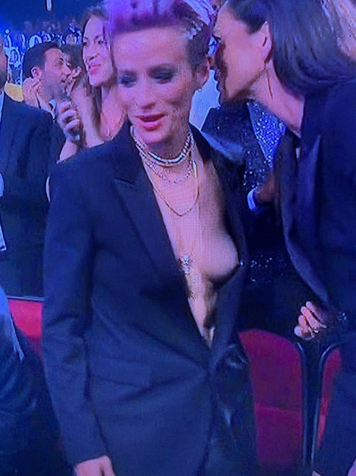 Tits fell on stage