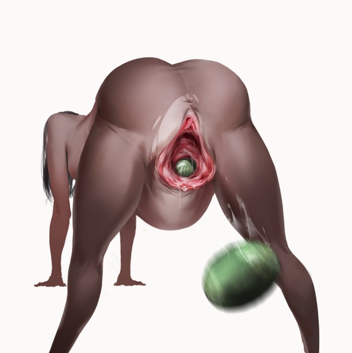 Cervix prolapse pregnant