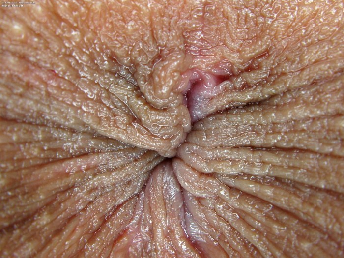 Brown anus is large