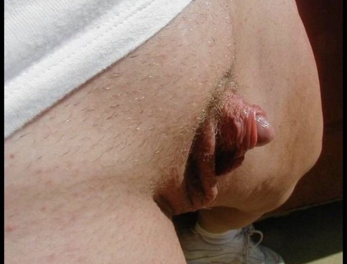 A huge clitoris sticks out
