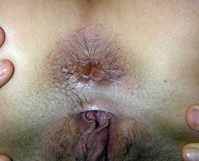 Anal hole Sabrina Dacos