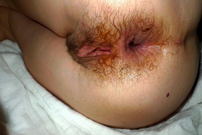 Hairy female anus close -up